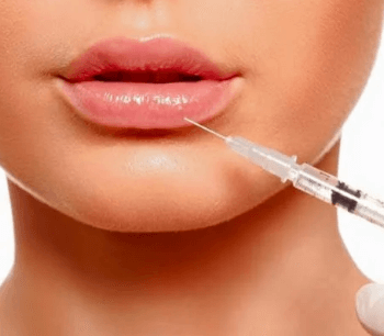  Botox 3 Regiões + preenchimento labial